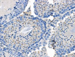 Invitrogen Phospho-ASAP2 (Ser701) Polyclonal Antibody 100 &mu;L; Unconjugated:Antibodies,