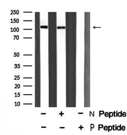 Invitrogen Phospho-ASAP2 (Ser701) Polyclonal Antibody 100 &mu;L; Unconjugated:Antibodies,