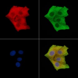 Invitrogen Phospho-DOK2 (Tyr139) Polyclonal Antibody 100 &mu;L | Buy Online | Invitrogen&trade; | Fisher Scientific