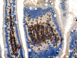 Invitrogen Phospho-DOK2 (Tyr139) Polyclonal Antibody 100 &mu;L | Buy Online | Invitrogen&trade; | Fisher Scientific