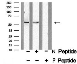 Invitrogen Phospho-DOK2 (Tyr139) Polyclonal Antibody 100 &mu;L | Buy Online | Invitrogen&trade; | Fisher Scientific