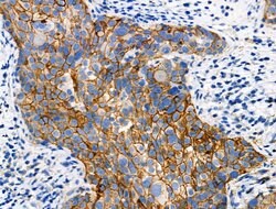 Invitrogen Phospho-GRK1/GRK2 (Tyr13) Polyclonal Antibody 100 &mu;L; Unconjugated:Antibodies,