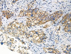 Invitrogen Phospho-GRK1/GRK2 (Tyr13) Polyclonal Antibody 100 &mu;L; Unconjugated:Antibodies,