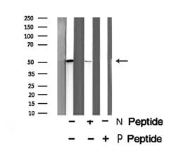 Invitrogen Phospho-HTRA2 (Ser142) Polyclonal Antibody 100 &mu;L | Buy Online | Invitrogen&trade; | Fisher Scientific