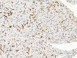 Invitrogen Phospho-PKC alpha (Ser657) Polyclonal Antibody 100 &mu;L; Unconjugated:Antibodies,