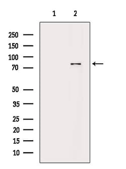 Invitrogen Phospho-PKC alpha (Ser657) Polyclonal Antibody 100 &mu;L; Unconjugated:Antibodies,