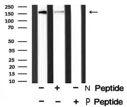 Invitrogen Phospho-ALK (Tyr1078) Polyclonal Antibody 100 &mu;L; Unconjugated:Antibodies,