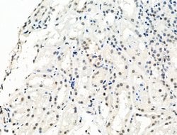 Invitrogen Phospho-Bcl-3 (Ser402) Polyclonal Antibody 100 &mu;L; Unconjugated:Antibodies,