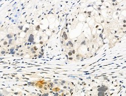Invitrogen Phospho-Bcl-3 (Ser402) Polyclonal Antibody 100 &mu;L; Unconjugated:Antibodies,