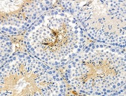 Invitrogen Phospho-eIF2 beta (Ser67) Polyclonal Antibody 100 &mu;L; Unconjugated:Antibodies,