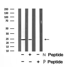Invitrogen Phospho-RRAS (Tyr66) Polyclonal Antibody 100 &mu;L; Unconjugated:Antibodies,