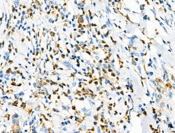 Invitrogen Phospho-RSK2 (Tyr529) Polyclonal Antibody 100 &mu;L; Unconjugated:Antibodies,