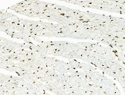 Invitrogen Phospho-RSK2 (Tyr529) Polyclonal Antibody 100 &mu;L; Unconjugated:Antibodies,