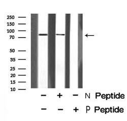 Invitrogen Phospho-RSK2 (Tyr529) Polyclonal Antibody 100 &mu;L; Unconjugated:Antibodies,