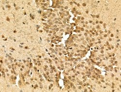 Invitrogen Phospho-TOP2A (Ser1337) Polyclonal Antibody 100 &mu;L; Unconjugated:Antibodies,