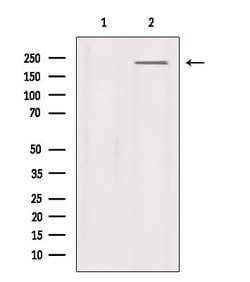 Invitrogen SCN9A Polyclonal Antibody 100 &mu;L; Unconjugated:Antibodies,