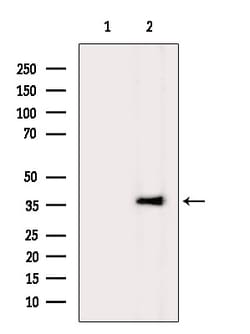 Invitrogen TBXA2R Polyclonal Antibody 100 &mu;L; Unconjugated:Antibodies,