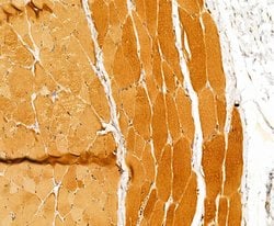 Invitrogen Myosin 4 Polyclonal Antibody 100 &mu;L | Buy Online | Invitrogen&trade; | Fisher Scientific