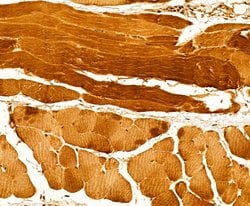Invitrogen Myosin 4 Polyclonal Antibody 100 &mu;L | Buy Online | Invitrogen&trade; | Fisher Scientific