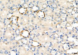 Invitrogen NKCC1 Polyclonal Antibody 100 &mu;L; Unconjugated:Antibodies,