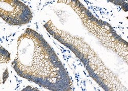 Invitrogen NKCC1 Polyclonal Antibody 100 &mu;L; Unconjugated:Antibodies,