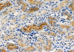 Invitrogen NKCC1 Polyclonal Antibody 100 &mu;L; Unconjugated:Antibodies,