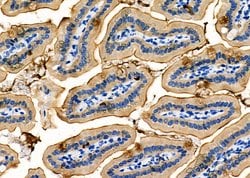 Invitrogen NKCC1 Polyclonal Antibody 100 &mu;L; Unconjugated:Antibodies,