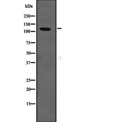 Invitrogen NKCC1 Polyclonal Antibody 100 &mu;L; Unconjugated:Antibodies,