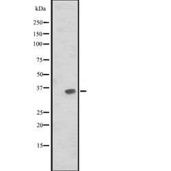 Invitrogen JAM2 Polyclonal Antibody 100 &mu;L | Buy Online | Invitrogen&trade; | Fisher Scientific