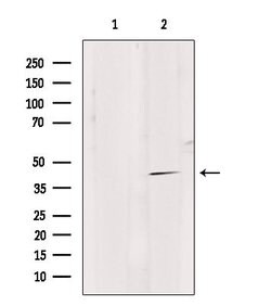 Invitrogen GPR4 Polyclonal Antibody 100 &mu;L | Buy Online | Invitrogen&trade; | Fisher Scientific