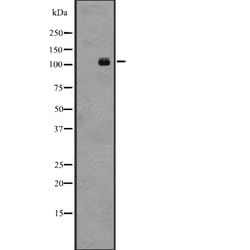 Invitrogen LGR4 Polyclonal Antibody 100 &mu;L | Buy Online | Invitrogen&trade; | Fisher Scientific