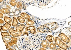 Invitrogen GPR89A Polyclonal Antibody 100 &mu;L; Unconjugated:Antibodies,