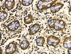 Invitrogen HnRNP Q Polyclonal Antibody 100 &mu;L; Unconjugated:Antibodies,