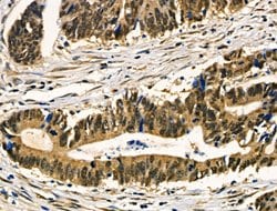 Invitrogen HnRNP Q Polyclonal Antibody 100 &mu;L; Unconjugated:Antibodies,