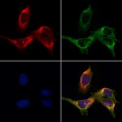 Invitrogen TROP2 Polyclonal Antibody 100 &mu;L; Unconjugated:Antibodies,