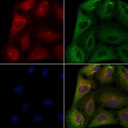 Invitrogen TROP2 Polyclonal Antibody 100 &mu;L; Unconjugated:Antibodies,