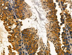 Invitrogen TROP2 Polyclonal Antibody 100 &mu;L; Unconjugated:Antibodies,