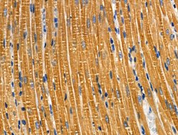 Invitrogen TROP2 Polyclonal Antibody 100 &mu;L; Unconjugated:Antibodies,