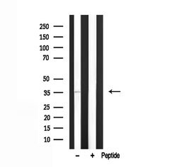 Invitrogen TROP2 Polyclonal Antibody 100 &mu;L; Unconjugated:Antibodies,