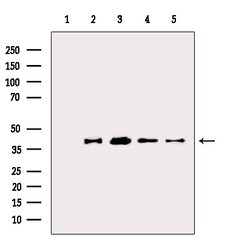Invitrogen TROP2 Polyclonal Antibody 100 &mu;L; Unconjugated:Antibodies,