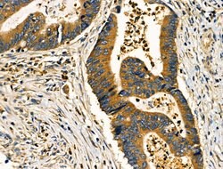 Invitrogen PRKCSH Polyclonal Antibody 100 &mu;L; Unconjugated:Antibodies,