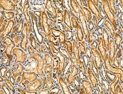 Invitrogen PRKCSH Polyclonal Antibody 100 &mu;L; Unconjugated:Antibodies,