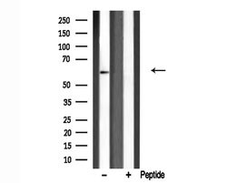 Invitrogen PRKCSH Polyclonal Antibody 100 &mu;L; Unconjugated:Antibodies,