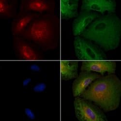 Invitrogen CKMT2 Polyclonal Antibody 100 &mu;L; Unconjugated:Antibodies,