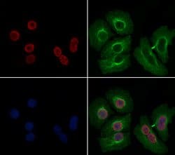 Invitrogen CRP1 Polyclonal Antibody 100 &mu;L; Unconjugated:Antibodies,