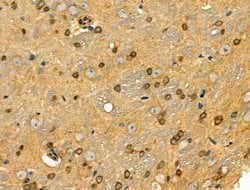 Invitrogen CRP1 Polyclonal Antibody 100 &mu;L; Unconjugated:Antibodies,