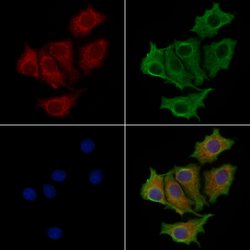 ACVRL1 Polyclonal Antibody, Invitrogen 100 &mu;L; Unconjugated:Antibodies,