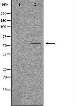 ACVRL1 Polyclonal Antibody, Invitrogen 100 &mu;L; Unconjugated:Antibodies,