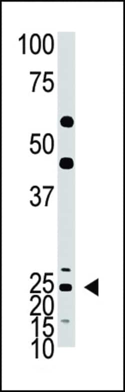 Invitrogen ASCL1 Polyclonal Antibody 400 &mu;L; Unconjugated:Antibodies,