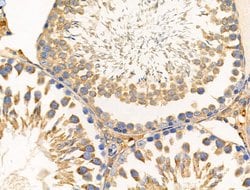 Invitrogen DOK4 Polyclonal Antibody 100 &mu;L | Buy Online | Invitrogen&trade; | Fisher Scientific